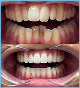 Improve your Smile
