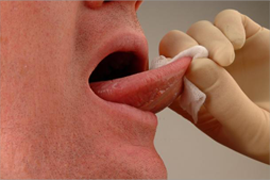 mouth cancer soft tissue