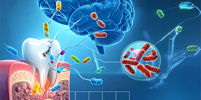 Oral Microbiome Matters Beyond The Mouth